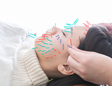 美顔鍼コースの写真