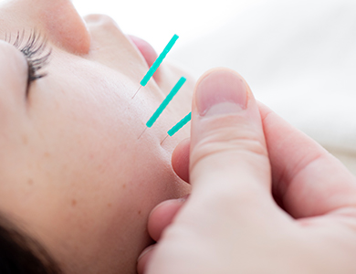 炭酸小顔鍼コースの写真