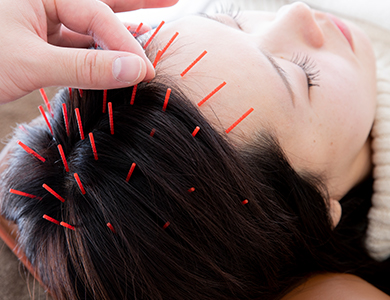 美髪・頭皮鍼コースの写真