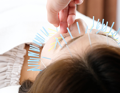 整形鍼コースの写真