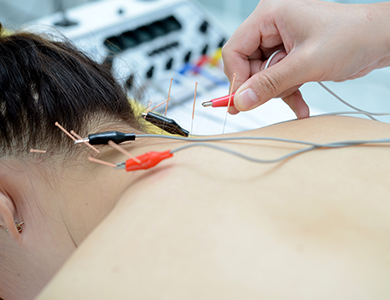 お体の鍼の写真